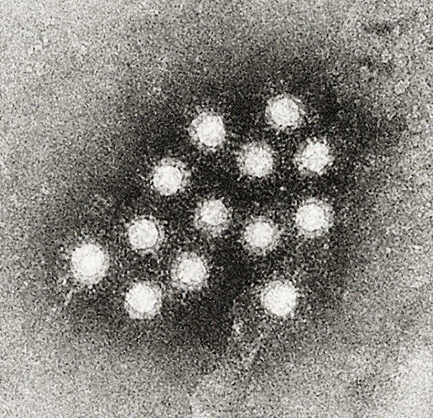 hepatita-a-virus